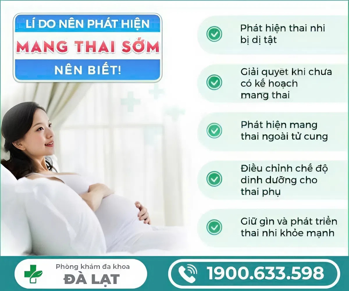 Hình ảnh minh họa